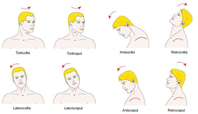 découvrez pourquoi certaines assurances refusent la couverture en cas de cambriolage nocturne et comment choisir une protection adaptée pour votre domicile.